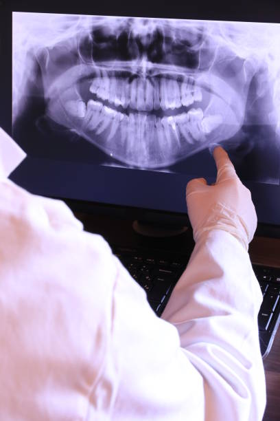 Best Broken or Cracked Tooth Emergency Dentist in Galena, IN